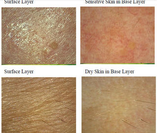 Facial Uv Skin Analyzer Machine For Skin Mositure / Grease / Wrinkle / Pigmentation
